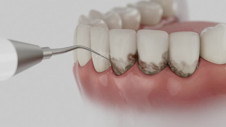 Reliable Tooth Extraction contractor in Johnson County County, TX by Dentist Open Now